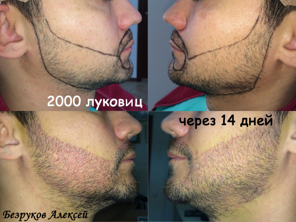 Борода До и После